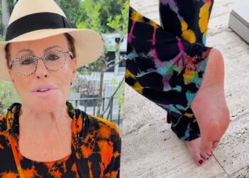 Ana Maria Braga mostra o pé após pisar em escorpião: ‘Olha a situação’