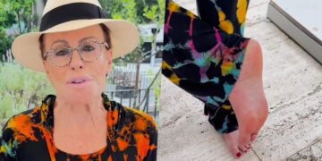Ana Maria Braga mostra o pé após pisar em escorpião: ‘Olha a situação’